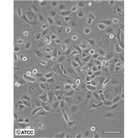 人類成淋巴細胞系GM12892
