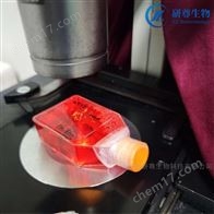 人類成淋巴細胞系GM12892