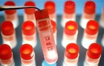 GIBCO澳洲胎牛血清