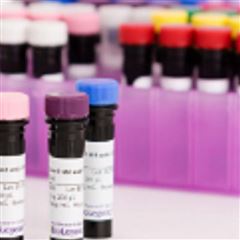 425101Tag-it Violet™ Proliferation