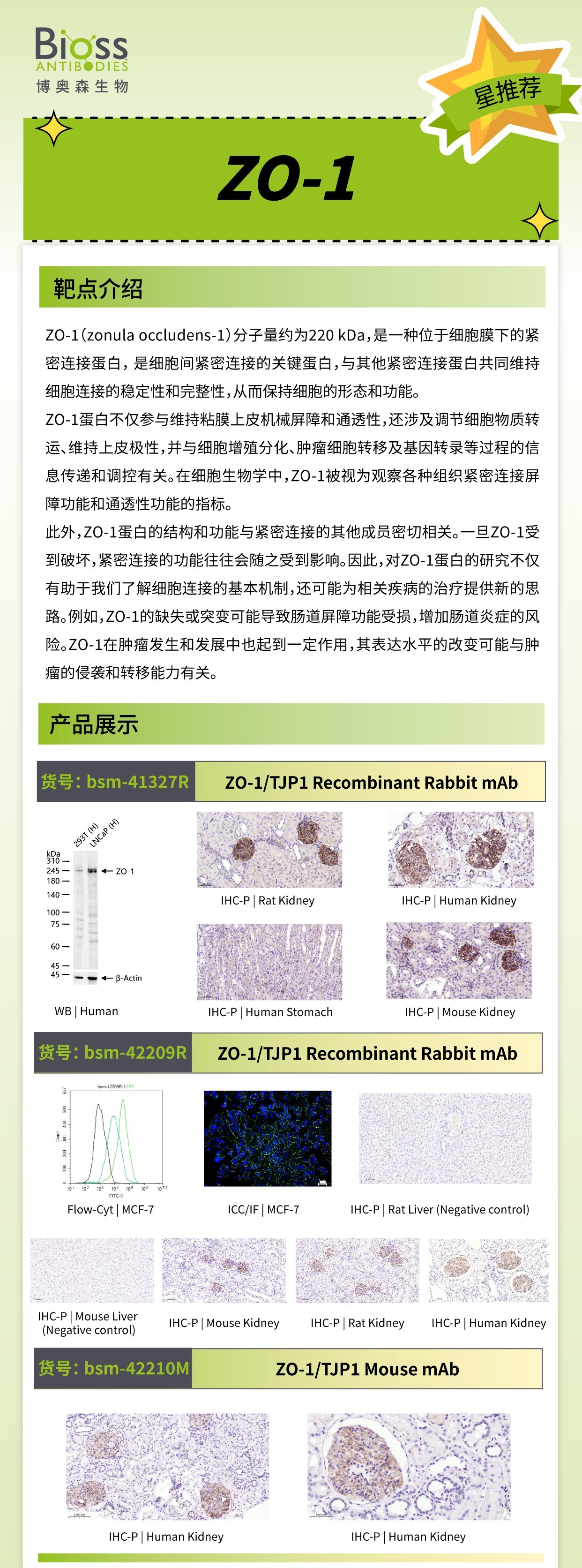 Bioss 星推薦 | ZO-1 抗體