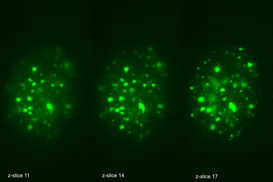 显微课堂 | 罕见疾病 CRISPR 疗法的开发与风险解除