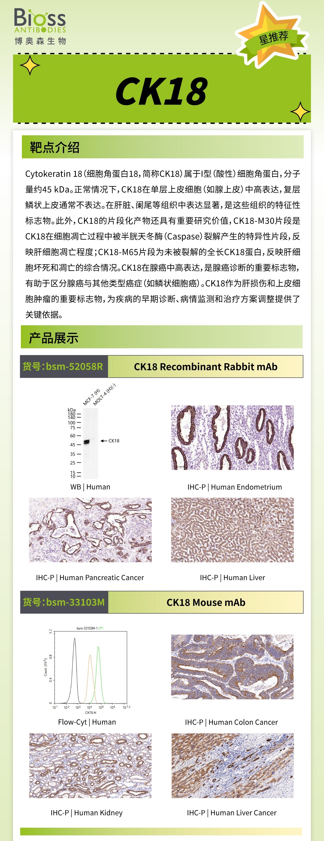 CK18 v1.jpg CK18 v1.jpg