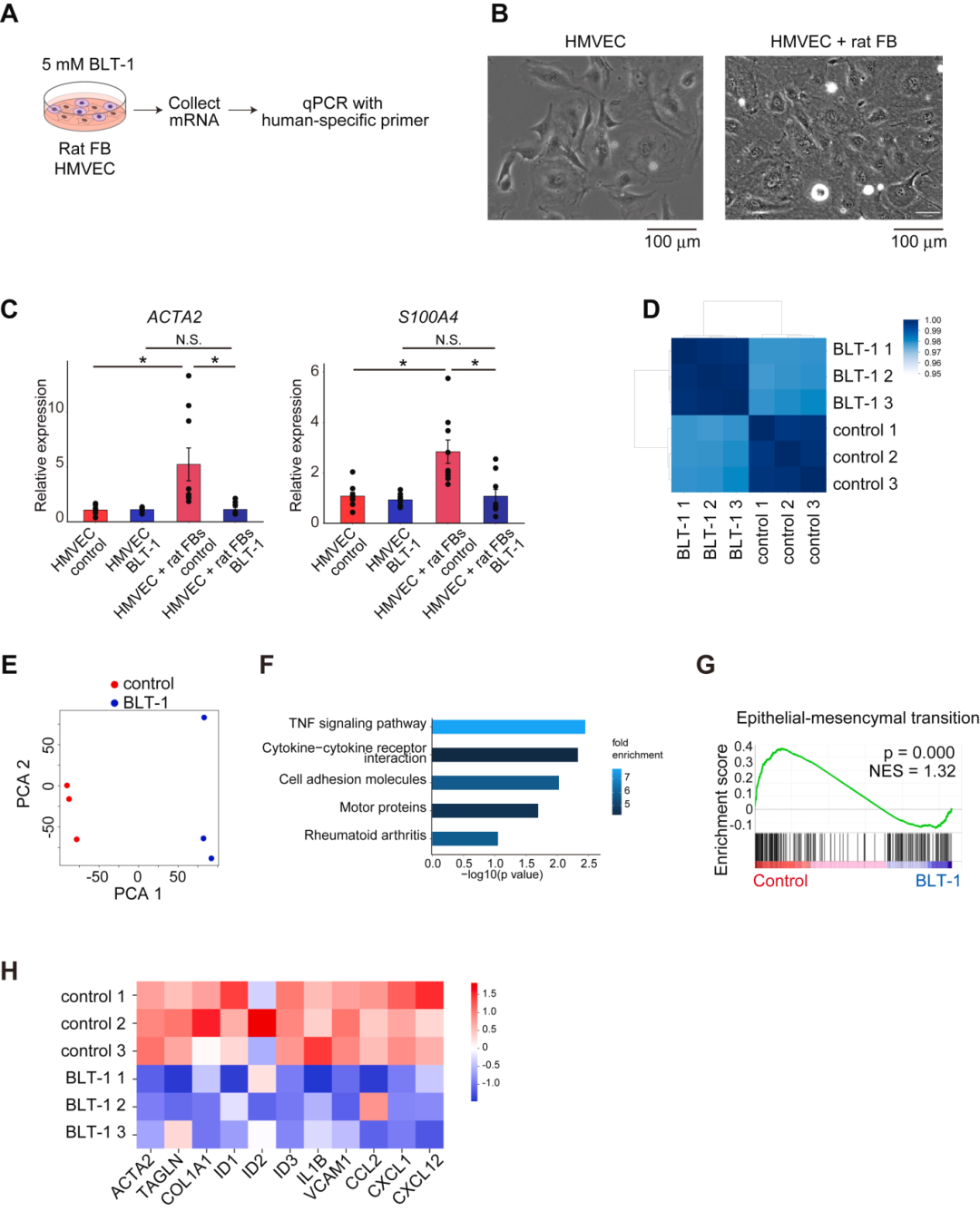 抑制内皮细胞 Scarb1 可减轻压力超负荷诱导的心力衰竭进展
