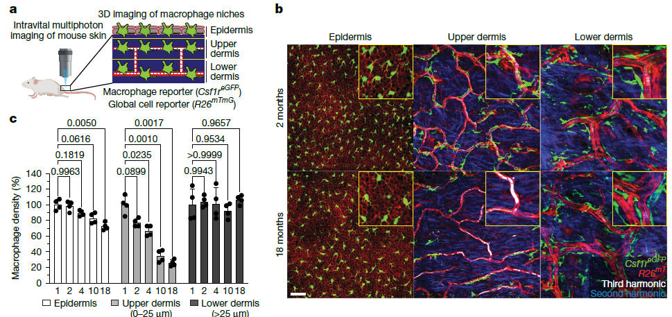 皮膚巨噬細(xì)胞的分類(lèi)和功能