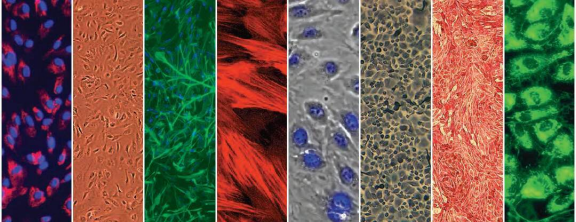 LONZA原代人主动脉内皮细胞HAEC, Human Aortic Endothelial Cells产品介绍