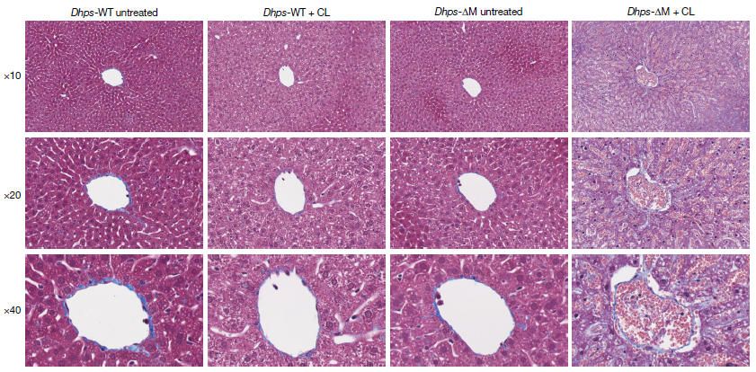 《Nature》：單核細胞轉化為組織駐留巨噬細胞的開關-DHPS