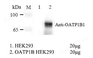 WB-75080.jpg OATP1B1 HEK293