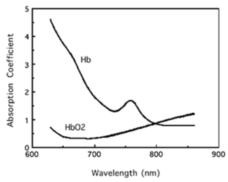 Omegawave BOM-L1TRSF近红外组织血氧监测仪